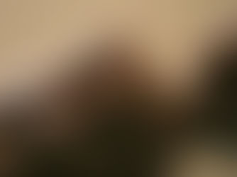 Chronic Kidney Disease and its Impact on Blood Sugar