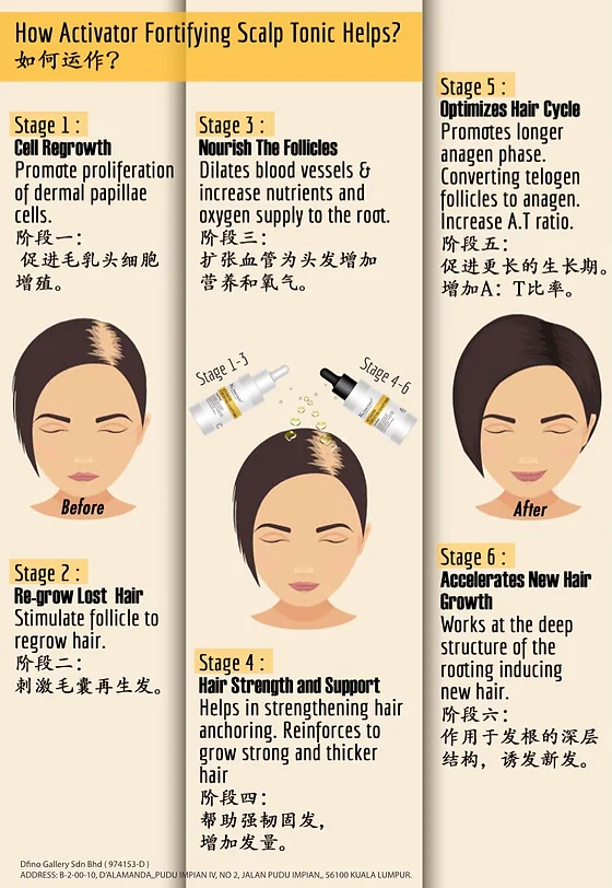 HAIR LOSS TREATMENT kosenze