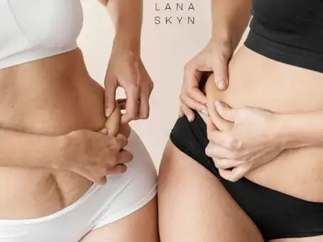 Love Handles Vrouw: Hoe Verminder Je Dit Hardnekkige Vet?