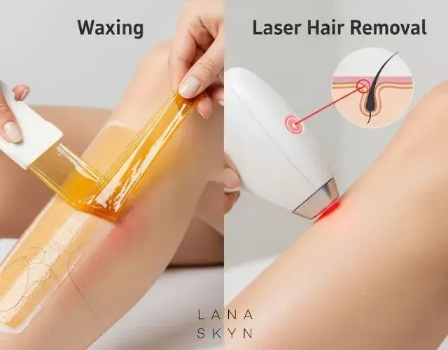 Comparing Waxing and Laser Hair Removal