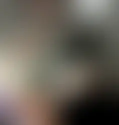 Belly Hair Removal for Women with Laser: How Effective Is It Compared to Shaving or Waxing?