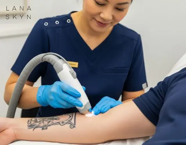 tattoo-verwijderen-ervaringen