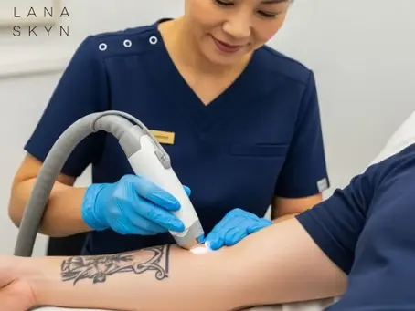 Tattoo Removal Experiences: The Truth Behind Pain, Results, and Costs