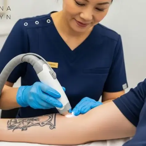 Tattoo Removal Experiences: The Truth Behind Pain, Results, and Costs