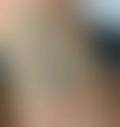 Grote Tattoo Verwijderen: Veelvoorkomende Uitdagingen en Hoe Experts Deze Overwinnen