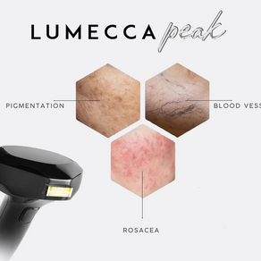 You’re Invited: Experience the Future of Skin Rejuvenation at Prestige Laser & Skin Clinic on June 26th!