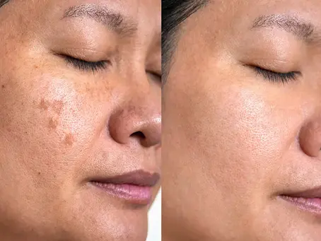 The Future of Skincare: Personalized, Science-Driven, and Results-Focused