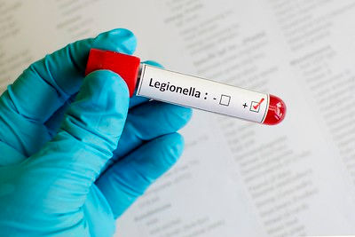'Unsafe' Legionella claim as Mary Feilding Guild set to close early