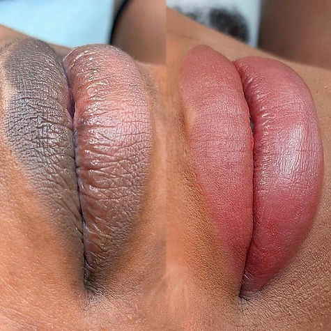 Melanin Rich Lips Correction