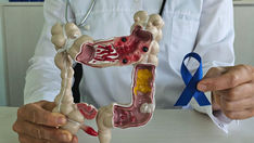 Five Silent Symptoms of Rectal Cancer You Should Know