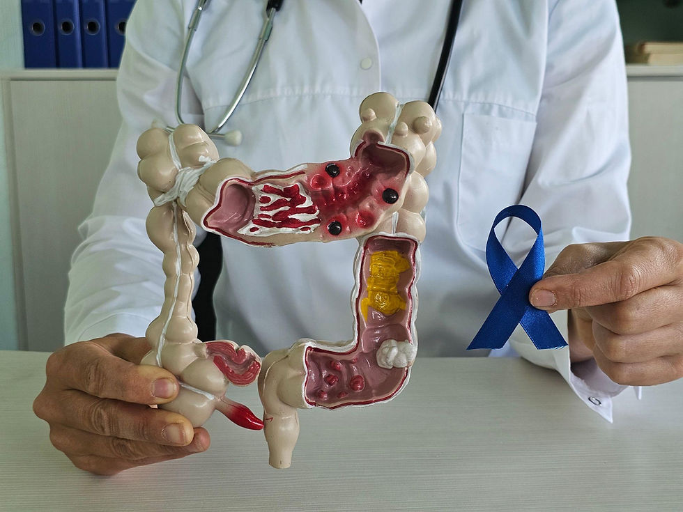 Five Silent Symptoms of Rectal Cancer You Should Know