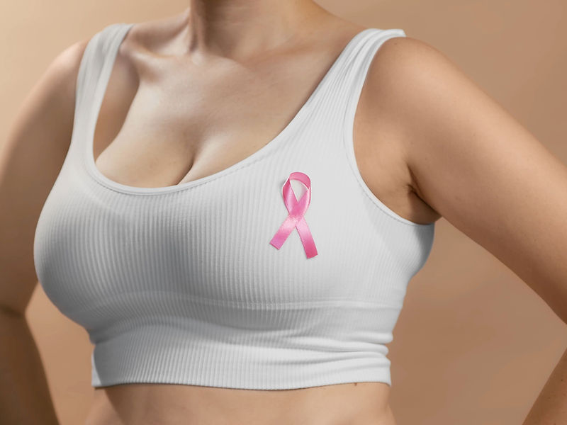 Oncoplastic Breast Surgery