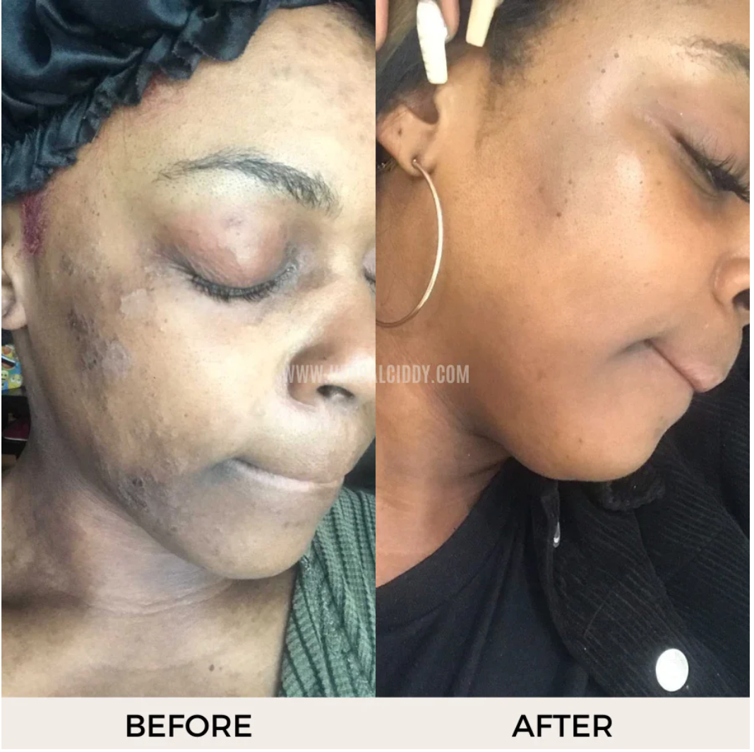 Sea Moss Serum