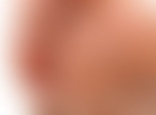 Verrucae Explained - Causes, Symptoms & The Best Treatment Options