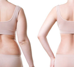 10 Exercises to Kill Back Fat Your Body Can’t Wait to Try