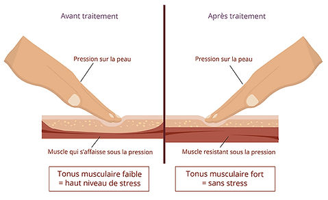 test musculaire