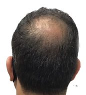 male -vertex before_edited.png