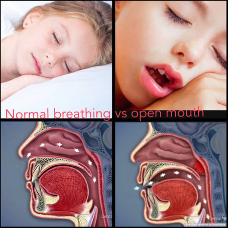 Airway-focused chiropractic care in Richmond, BC assessing cranial, cervical, and oral structures to improve breathing and posture.