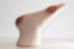 Bed Sore Foot