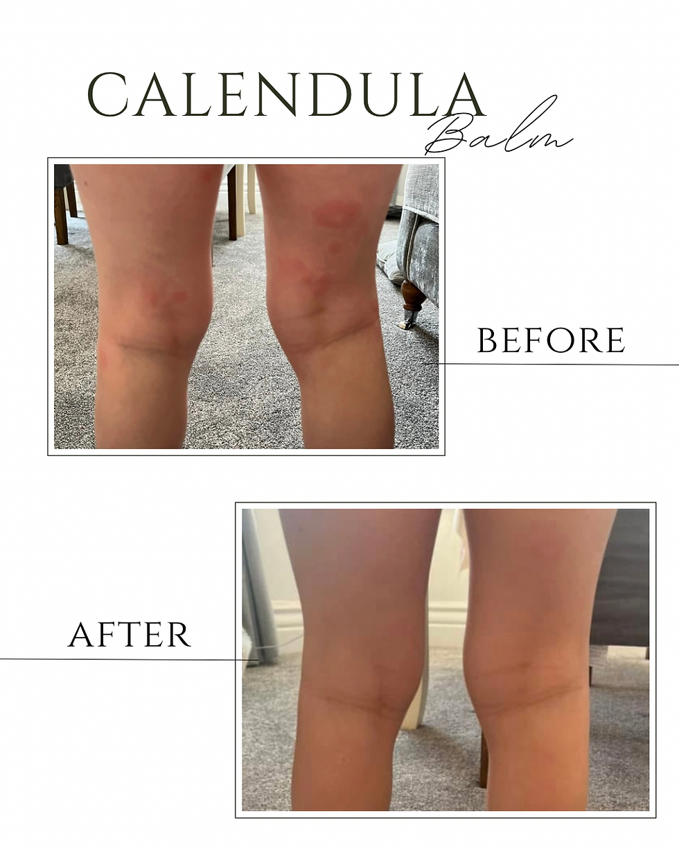 Thumbnail: Organic Calendula Balm