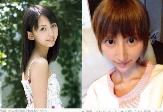 整容失败惨不忍睹的十大女星