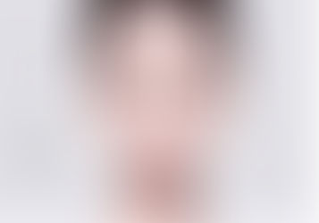 整形專家告訴你常見的整容後遺症有哪些