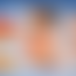 Piel gruesa en rinoplastia: cómo afecta los resultados y qué se puede lograr