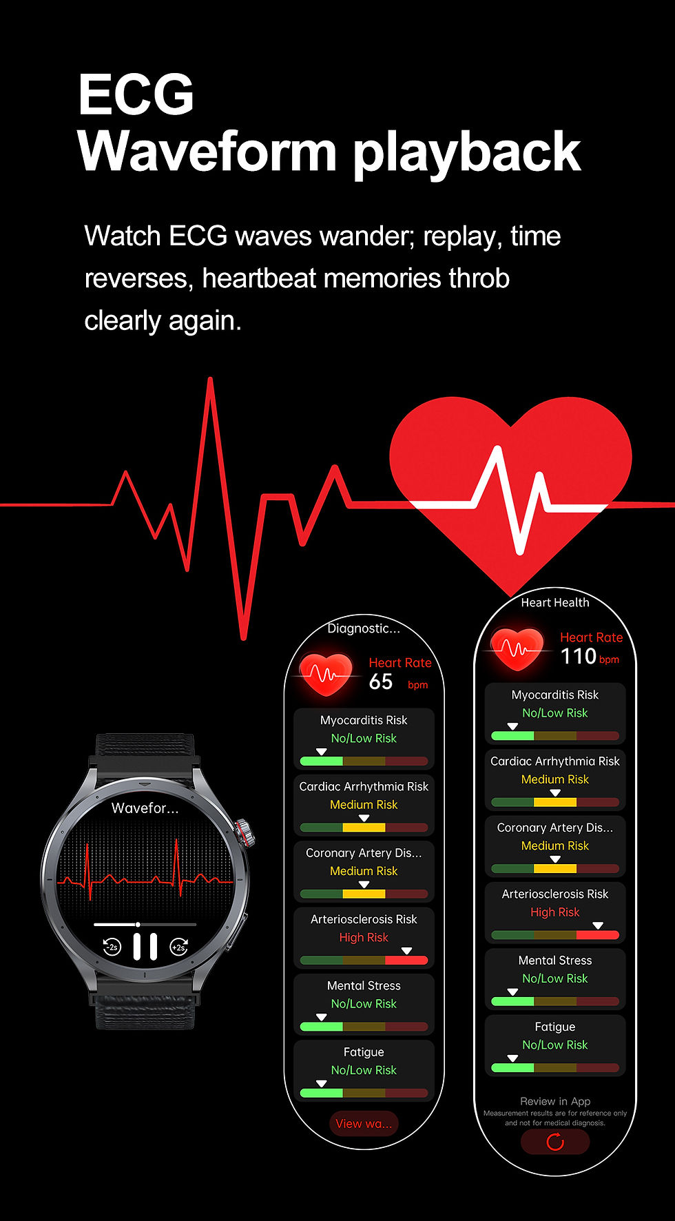 Thumbnail: 2025 New ECG+PPG Smart Watch Blood lipids Uric acid BP Bracelet Men AI-GPT Sport