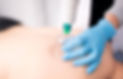 cupping-therapy-hero-1.jpeg
