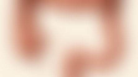 Επείγουσα χειρουργική αντιμετώπιση συστροφής τυφλού εντέρου, σε 60χρονο ασθενή