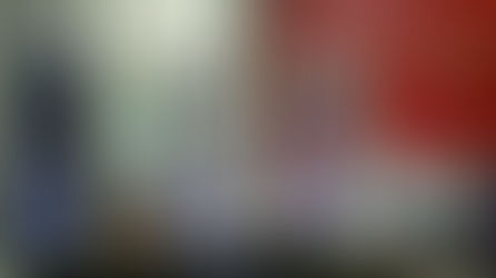 Are 3D Printed Prosthetic Devices More Affordable than the Traditional Prosthetic Devices?