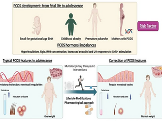 PCOS Has a New Name: Understanding Polyendocrine Metabolic Ovarian Syndrome (PMOS)