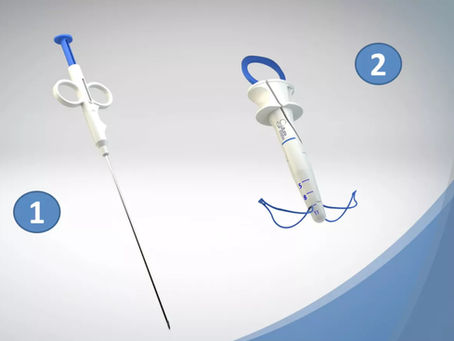 Mastering the Laparoscopic Knot Pusher for Faster Surgical Closure
