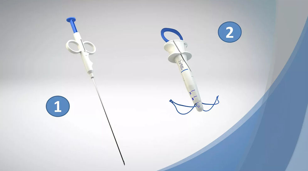 Mastering the Laparoscopic Knot Pusher for Faster Surgical Closure