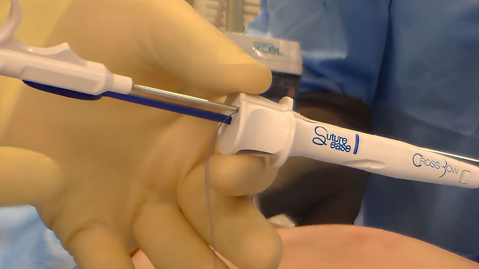 Why Manual Laparoscopic Port Site Closure Is Becoming Obsolete
