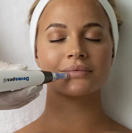 Dermapen 4 Microneedling Oslo