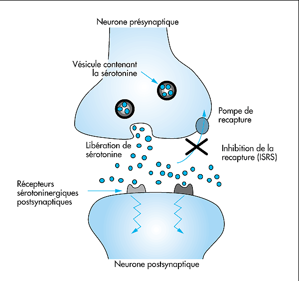 Syndrome-sérotoninergique.gif