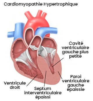 coeur-cardio.jpg