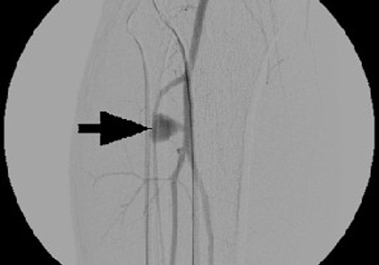 Fig-1-Trauma-vasc_large.jpg