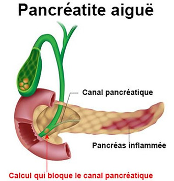 image_4085_400.jpg