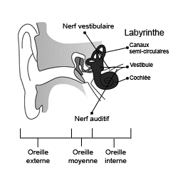 labyrintite.gif