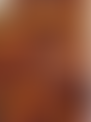 Crispy Korean spicy pork belly slices cooked in an air fryer, served with lettuce and rice on a plate.