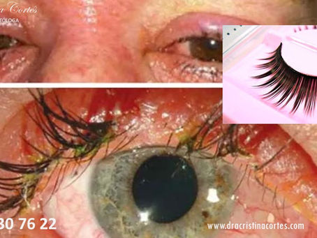 El abuso de las pestañas postizas puede generar daño irreversible a los ojos.