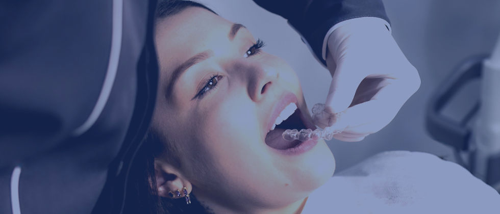 Safe delivery of clear aligner