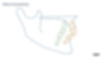 Relative orthodontic intrusion/extrusion