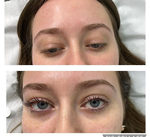 before and after lash extensions