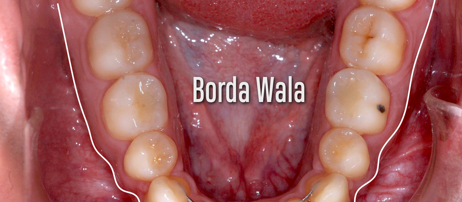 Borda Wala.
