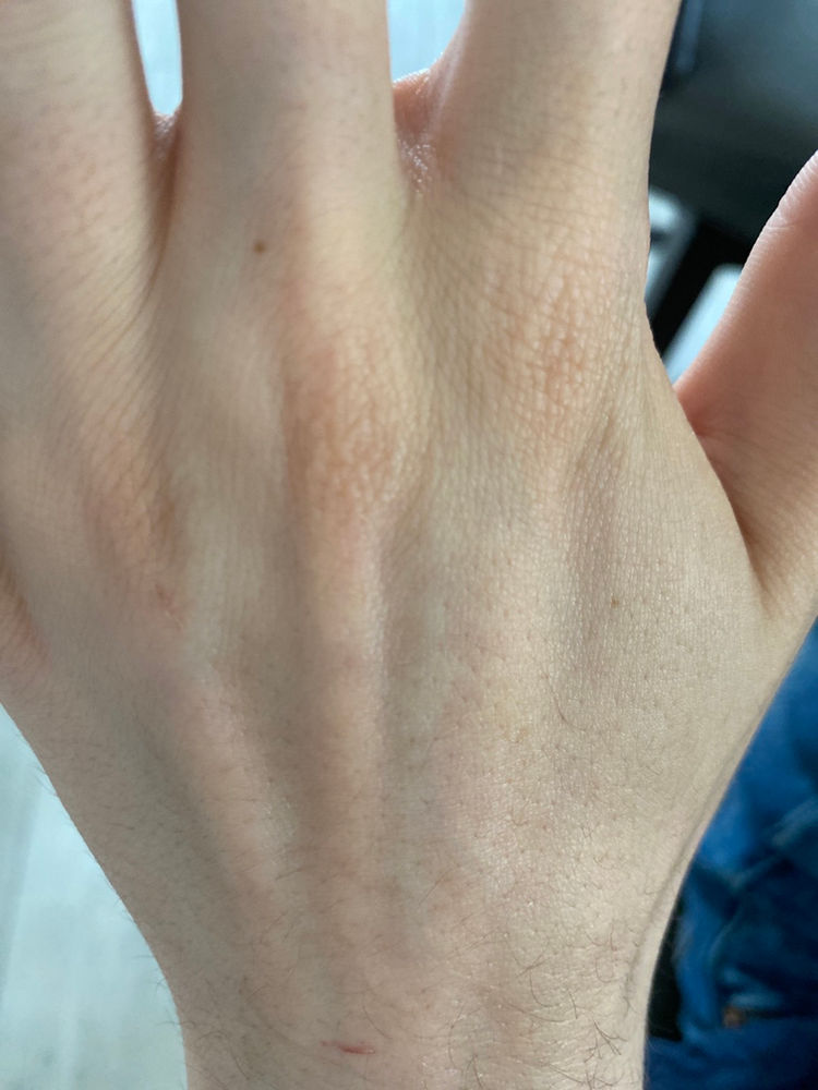 Removing Epoxy Resin from your Skin