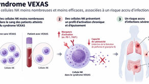 Infographie : dans le syndrome VEXAS, les cellules NK sont moins nombreuses, épuisées et moins capables de tuer, ce qui est associé à un risque accru d'infections sévères.