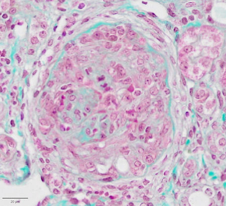 Glomérule rénal dans un modèle expérimental de vascularite